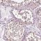 Preferentially Expressed Antigen In Melanoma antibody, NBP1-85418, Novus Biologicals, Immunohistochemistry frozen image 