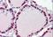 Cellular Retinoic Acid Binding Protein 1 antibody, orb88977, Biorbyt, Immunohistochemistry paraffin image 
