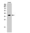 Serpin Family E Member 1 antibody, A00637, Boster Biological Technology, Western Blot image 