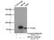 ABCD1 antibody, 18138-1-AP, Proteintech Group, Immunoprecipitation image 