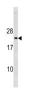 Cyclin Dependent Kinase Inhibitor 1B antibody, abx034671, Abbexa, Western Blot image 