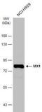 MX Dynamin Like GTPase 1 antibody, NBP1-32905, Novus Biologicals, Western Blot image 