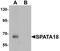 Spermatogenesis Associated 18 antibody, PA5-72739, Invitrogen Antibodies, Western Blot image 