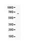 Lipopolysaccharide Binding Protein antibody, PA5-79585, Invitrogen Antibodies, Western Blot image 