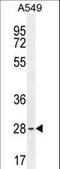 Basic Transcription Factor 3 antibody, LS-C156881, Lifespan Biosciences, Western Blot image 