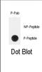 Telomerase Reverse Transcriptase antibody, abx032054, Abbexa, Dot Blot image 