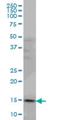 Phosphodiesterase 6D antibody, H00005147-M06, Novus Biologicals, Western Blot image 