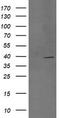 Dual specificity mitogen-activated protein kinase kinase 3 antibody, TA505876, Origene, Western Blot image 