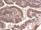 Tubulin Beta 2A Class IIa antibody, NBP2-15581, Novus Biologicals, Immunohistochemistry paraffin image 