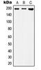 IQ Motif Containing GTPase Activating Protein 1 antibody, LS-C353097, Lifespan Biosciences, Western Blot image 