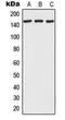 RNA Polymerase II Associated Protein 1 antibody, orb215114, Biorbyt, Western Blot image 