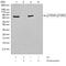 Ribosomal Protein S6 Kinase B1 antibody, 701064, Invitrogen Antibodies, Western Blot image 