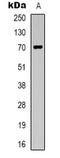 Solute Carrier Family 6 Member 6 antibody, LS-B14573, Lifespan Biosciences, Western Blot image 