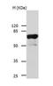 Interleukin 23 Receptor antibody, TA321935, Origene, Western Blot image 