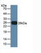 T Cell Immunoreceptor With Ig And ITIM Domains antibody, LS-C296584, Lifespan Biosciences, Western Blot image 