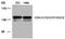 Histone Deacetylase 4 antibody, AP08090PU-S, Origene, Western Blot image 