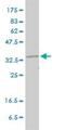 RAD51 Recombinase antibody, H00005888-M01, Novus Biologicals, Western Blot image 