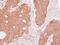 Diaphanous Related Formin 1 antibody, GTX102057, GeneTex, Immunohistochemistry paraffin image 