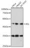 Argininosuccinate Lyase antibody, GTX55520, GeneTex, Western Blot image 