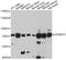 ADAM Metallopeptidase Domain 19 antibody, A10260, ABclonal Technology, Western Blot image 