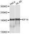 Kinesin Family Member 14 antibody, STJ112313, St John