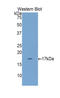 Regenerating Family Member 4 antibody, LS-C300852, Lifespan Biosciences, Western Blot image 