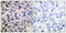 Matrix Metallopeptidase 14 antibody, LS-C118521, Lifespan Biosciences, Immunohistochemistry frozen image 