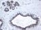 Palmitoyl-Protein Thioesterase 1 antibody, LS-C175416, Lifespan Biosciences, Immunohistochemistry paraffin image 