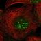 Zinc Finger And BTB Domain Containing 8A antibody, NBP1-88375, Novus Biologicals, Immunofluorescence image 