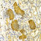 Protein Kinase C Epsilon antibody, A2110, ABclonal Technology, Immunohistochemistry paraffin image 