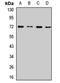 PRK antibody, LS-C668254, Lifespan Biosciences, Western Blot image 