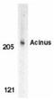 Apoptotic chromatin condensation inducer in the nucleus antibody, NBP1-76869, Novus Biologicals, Immunohistochemistry paraffin image 