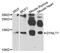 Dynein Light Chain Tctex-Type 1 antibody, STJ23453, St John