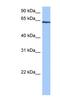 Tetratricopeptide Repeat Domain 6 antibody, NBP1-54927, Novus Biologicals, Western Blot image 