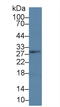 Linker For Activation Of T Cells antibody, LS-C314453, Lifespan Biosciences, Western Blot image 