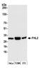 Four and a half LIM domains protein 2 antibody, A300-333A, Bethyl Labs, Western Blot image 