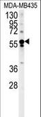 Rho Guanine Nucleotide Exchange Factor 3 antibody, LS-C156481, Lifespan Biosciences, Western Blot image 