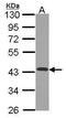 NADH:Ubiquinone Oxidoreductase Subunit A10 antibody, PA5-22348, Invitrogen Antibodies, Western Blot image 