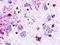 Neuromedin U Receptor 1 antibody, LS-A396, Lifespan Biosciences, Immunohistochemistry paraffin image 
