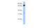 Zinc Finger And BTB Domain Containing 46 antibody, A11272, Boster Biological Technology, Western Blot image 