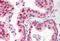 Teashirt Zinc Finger Homeobox 3 antibody, MBS248014, MyBioSource, Immunohistochemistry paraffin image 