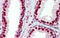 Small RNA Binding Exonuclease Protection Factor La antibody, 29-309, ProSci, Enzyme Linked Immunosorbent Assay image 