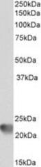 Rac Family Small GTPase 2 antibody, PA1-9091, Invitrogen Antibodies, Western Blot image 