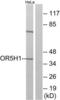 Olfactory Receptor Family 5 Subfamily H Member 1 antibody, LS-C120890, Lifespan Biosciences, Western Blot image 