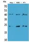 Transmembrane Protein 173 antibody, STJ96853, St John