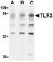 Toll Like Receptor 3 antibody, TA306268, Origene, Western Blot image 