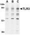 Toll Like Receptor 3 antibody, TA306268, Origene, Western Blot image 