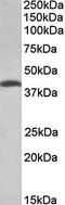 Threonine Synthase Like 2 antibody, orb79351, Biorbyt, Western Blot image 