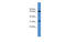 Sorting Nexin 18 antibody, MBS5300845, MyBioSource, Western Blot image 