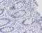 Ring Finger Protein 40 antibody, A06979-1, Boster Biological Technology, Immunohistochemistry paraffin image 